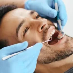 Ortodonti Nedir? Hangi Tedavileri Kapsar?